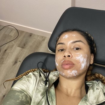 Reddy Aesthetics - While I was NUMB before my first resurfacing treatment - Medical Spas Near Me - Long Beach, California
