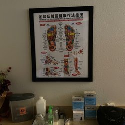 Rona's Acupuncture Clinic - Chart of areas of body to treat