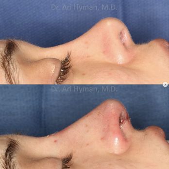 Ari Hyman, MD - Cosmetic Surgeons Near Me - Encino, California