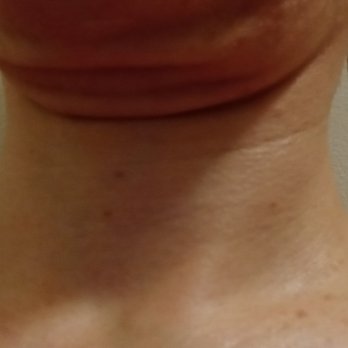 Pearlman D. Hicks Jr., M.D. - Dr. Hicks :-( - Cosmetic Surgeons Near Me - Long Beach, California Pearlman D. Hicks Jr., M.D. - Dr. Hicks :-( - Cosmetic Surgeons Near Me - Long Beach, California