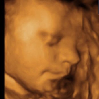 My First Image - Milagros is a Miracle Worker! I got to see my baby boys face for the first time! 3 - Diagnostic Imaging Near Me - Tucson, Arizona