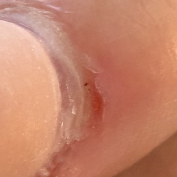 Nail Spa - Heavy drilling to nails and skin - Nail Salons Near Me - Towson, Maryland Nail Spa - Heavy drilling to nails and skin - Nail Salons Near Me - Towson, Maryland