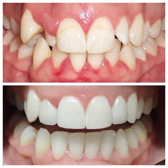 Williamsburg Dental - General Dentistry Near Me - Lincoln, Nebraska Williamsburg Dental - General Dentistry Near Me - Lincoln, Nebraska