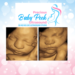 Precious Baby Peek Ultrasound