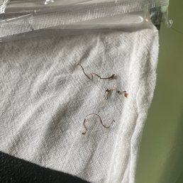 Metal in my food