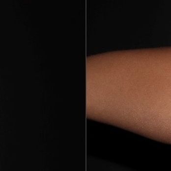 Neinstein Plastic Surgery - Pre-Op (With PAH Coolsculpting Deformity) - Plastic Surgeons Near Me - New York, New York
