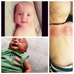 Christine Walinch, LAc - Acupuncture and Very Gentle Cupping for all ages. #Honolulu
#Oahu