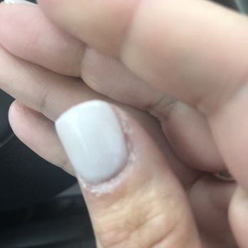 Nailed It Spa - Botched cuticles. - Nail Salons Near Me - Fort Wayne, Indiana