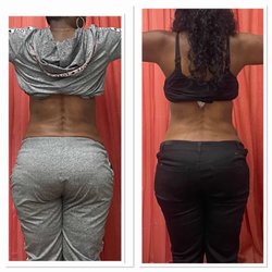 Body Sculpting by Syn