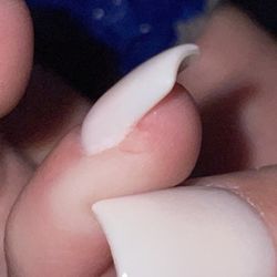 Diamond Nails - Chunk out of my skin from the file.