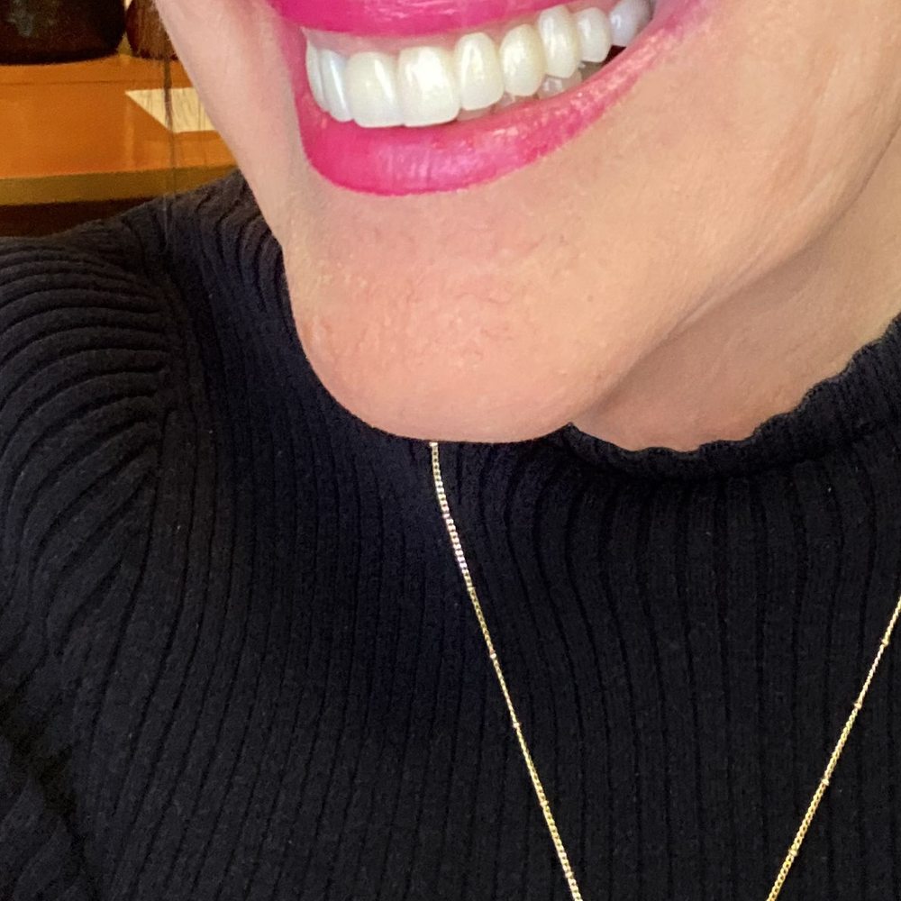 Bridgeport Aesthetic Dentistry - smile with new teeth - General Dentistry Near Me - Valencia, California