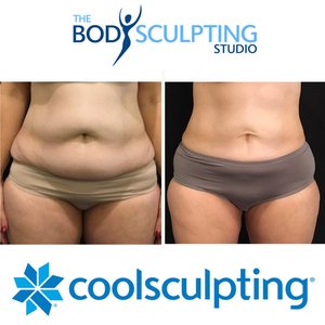 The Body Sculpting Studio on Yelp
