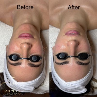 Idan Med Spa by null