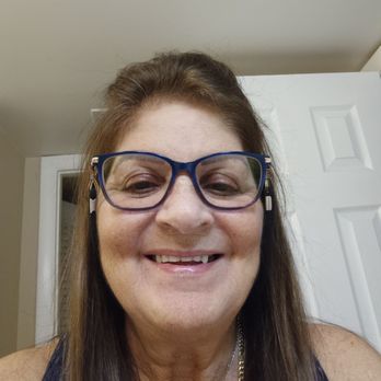 Dentistart - before my new dentures - General Dentistry Near Me - Coral Springs, Florida