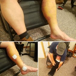Heath Chiropractic and Wellness Center - FSM therapy