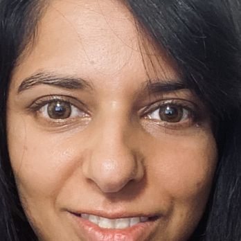 Radiance spa - Before facial Aug 2024 - no make up - Acupuncture Near Me - New York, New York Radiance spa - Before facial Aug 2024 - no make up - Acupuncture Near Me - New York, New York
