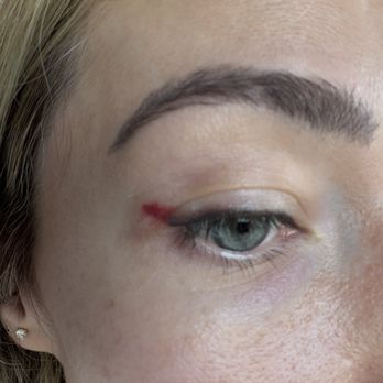 Lucy Hart Ink - laser_removal_right_eye - Permanent Makeup Near Me - Studio City, California