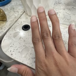 bad nail shape bad nail shape