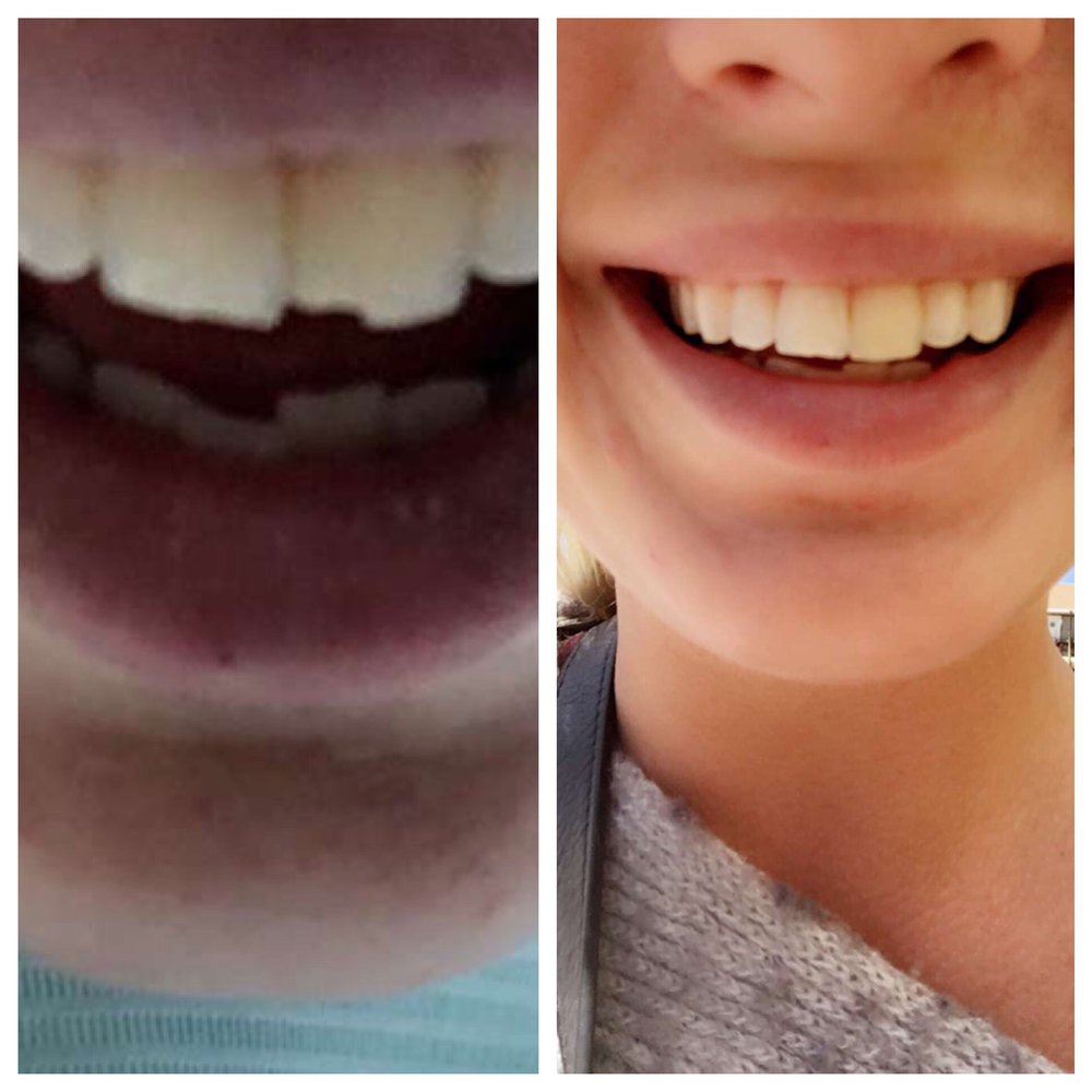 George D. Lim, DMD - This office successfully repaired my tooth so I can have a beautiful smile again - General Dentistry Near Me - Los Angeles, California George D. Lim, DMD - This office successfully repaired my tooth so I can have a beautiful smile again - General Dentistry Near Me - Los Angeles, California