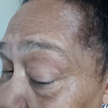 Pink and White Nails - Irritated eye after botched eyebrow waxing - Nail Salons Near Me - Hayward, California Pink and White Nails - Irritated eye after botched eyebrow waxing - Nail Salons Near Me - Hayward, California