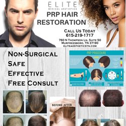 Elite Medical Aesthetics - Hair restoration with PRP is a non surgical treatment that works!