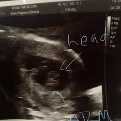 In Due Time 3d Ultrasound