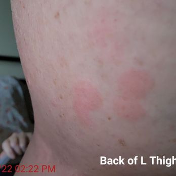 Heritage House Inn - Bed bugs. - Hotels Near Me - Muleshoe, Texas Heritage House Inn - Bed bugs. - Hotels Near Me - Muleshoe, Texas