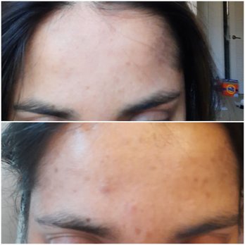 OC SkinLab - Dermatologists Near Me - San Juan Capistrano, California OC SkinLab - Dermatologists Near Me - San Juan Capistrano, California