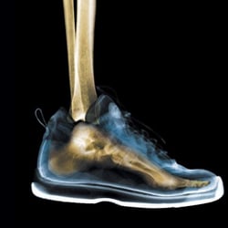 Bucktown Foot & Ankle Clinic