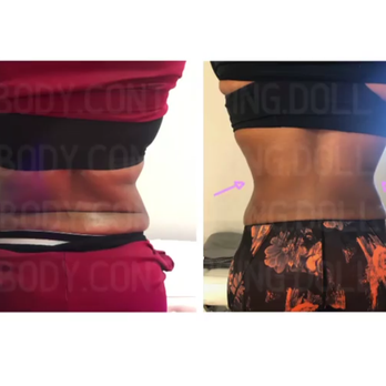 Body Contouring Doll - Teeth Whitening Near Me
