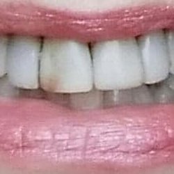 All Seasons Dental Care: Neal B Wanner, DDS