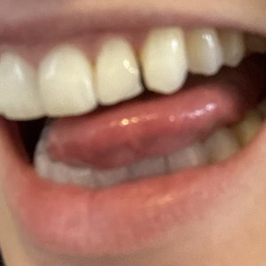 Vincent Dental on Yelp