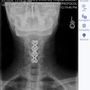 Photo of Emory Orthopaedics & Spine Center