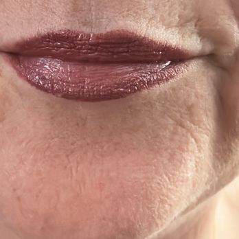 BotoxxCafe - Pre lip lift - Skin Care Near Me - Santa Clara, California BotoxxCafe - Pre lip lift - Skin Care Near Me - Santa Clara, California