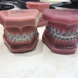Silcox Orthodontics - Exploring options