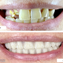 Precision Dental Specialties