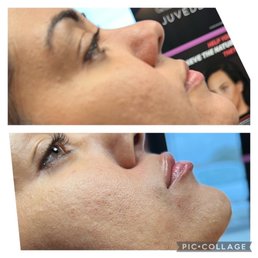 Before & After Before & After