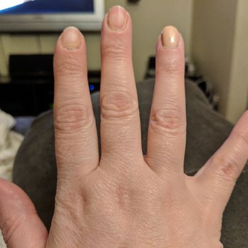 7 Day Spa - Saturday evening. One and a half days post-visit. 2 nails almost completely chipped off. - Nail Salons Near Me - Westchester, Illinois 7 Day Spa - Saturday evening. One and a half days post-visit. 2 nails almost completely chipped off. - Nail Salons Near Me - Westchester, Illinois