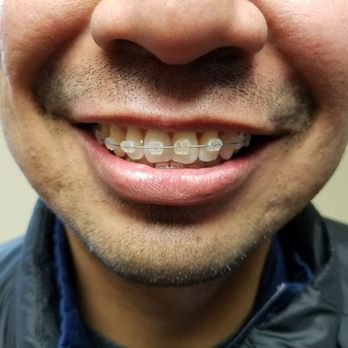 CaliSmile Orthodontics - Orthodontists Near Me - West Hills, California