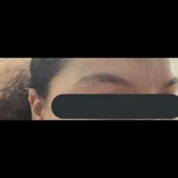 Before and after eyebrow threading. Before and after eyebrow threading.