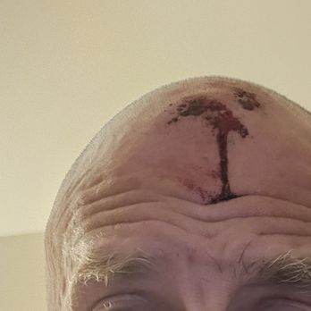 Eagleboltbar - Where my head hit the sidewalk. - Gay Bars Near Me - Minneapolis, Minnesota Eagleboltbar - Where my head hit the sidewalk. - Gay Bars Near Me - Minneapolis, Minnesota
