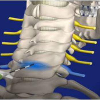 Spector Chiropractic - Chiropractors Near Me - Towson, Maryland Spector Chiropractic - Chiropractors Near Me - Towson, Maryland