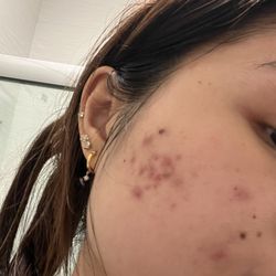 Skin Restoration Aesthetics - Before
