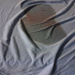 Premier ER & Urgent Care - Waco - I got into this room the sheet looked dry when i sat on it I got this instead not knowing who's blood if they have hiv or other diseases