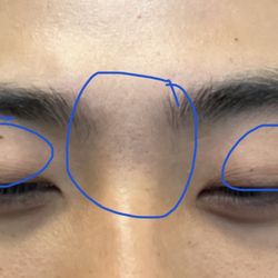 SOI Brow Threading - Before