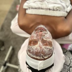 Facial treatment