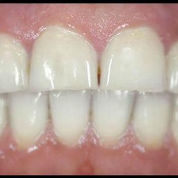 Crossroads Dental - untitled - Cosmetic Dentists Near Me - Grand Junction, Colorado Crossroads Dental - untitled - Cosmetic Dentists Near Me - Grand Junction, Colorado