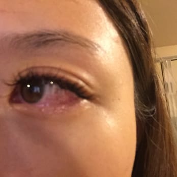 Beauty Plus Lashes - After the eyelash extension my eyes are still very red. This picture is taken after 6 hours of eyelash extension. - Eyelash Service Near Me - San Gabriel, California Beauty Plus Lashes - After the eyelash extension my eyes are still very red. This picture is taken after 6 hours of eyelash extension. - Eyelash Service Near Me - San Gabriel, California