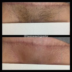 Bee Waxing Parlor - Before and after of a Brazilian wax.