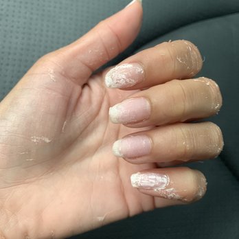 Davi Nails - Another horrible photo of what two hours of soaking your nails in acetone. - Nail Salons Near Me - State College, Pennsylvania